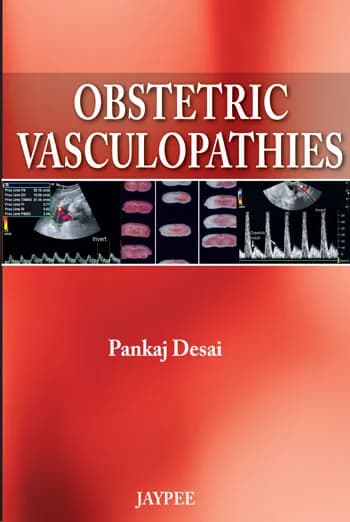 Image of - Obstetric Vasculopathies - 1st Edition