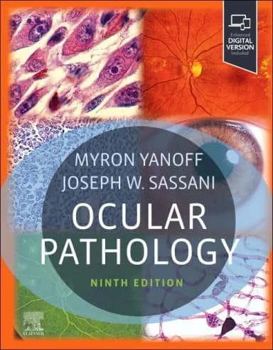 Image of - Ocular Pathology:  9E