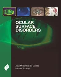 Thumbnail - OCULAR SURFACE DISORDERS