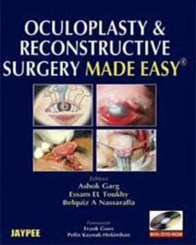 Image of - Oculoplasty And Reconstructive Surgery Made Easy With Dvd-rom - 1st Edition