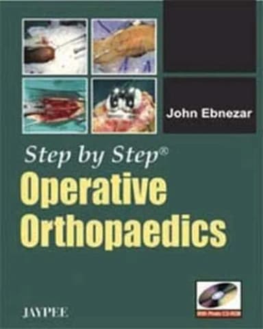 Image of - Step by Step Operative Orthopaedics with Photo Cd-rom - 1st Edition