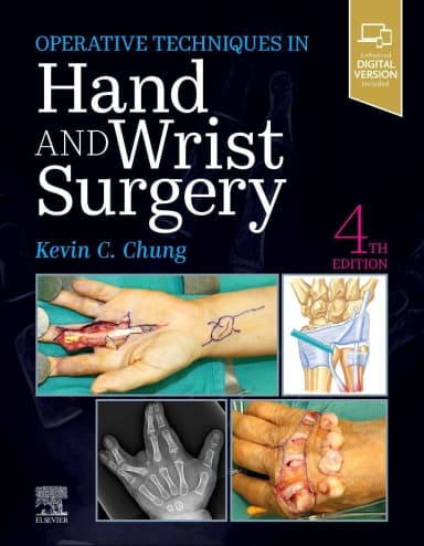 Image of - Operative Techniques: Hand and Wrist Surgery - 4E