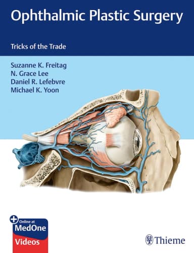 Image of - Ophthalmic Plastic Surgery 1st Ed.