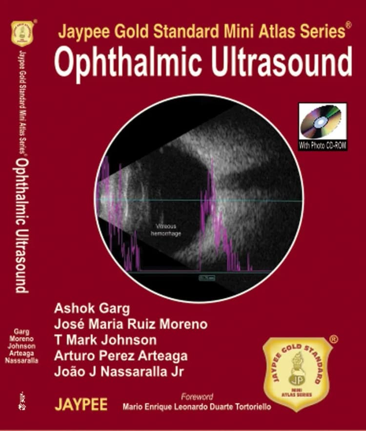 Ophthalmic Ultrasound Jaypee Gold Standard Mini Atlas Series  - 1st Edition