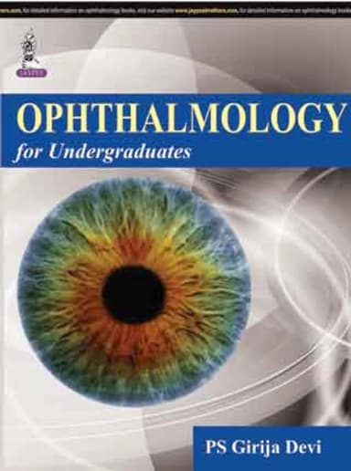 Image of - Ophthalmology for Undergraduates
