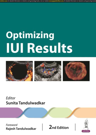 Image of - Optimizing IUI Results