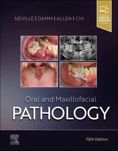 Image of - Oral and Maxillofacial Pathology - 5E