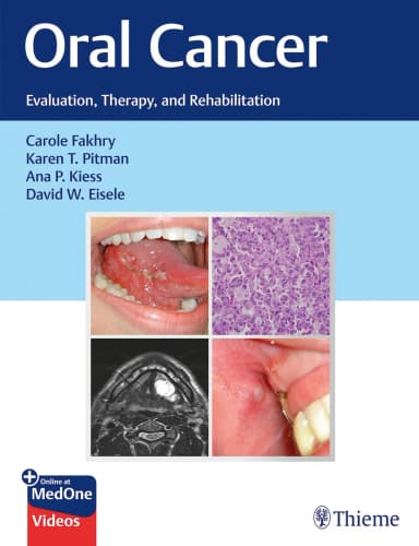 Image of - Oral Cancer : Evaluation, Therapy, and Rehabilitation 1st Ed.
