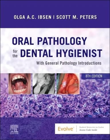 Image of - Oral Pathology for the Dental Hygienist - 8E