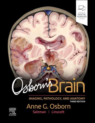 Image of - Osborn's Brain - 3E