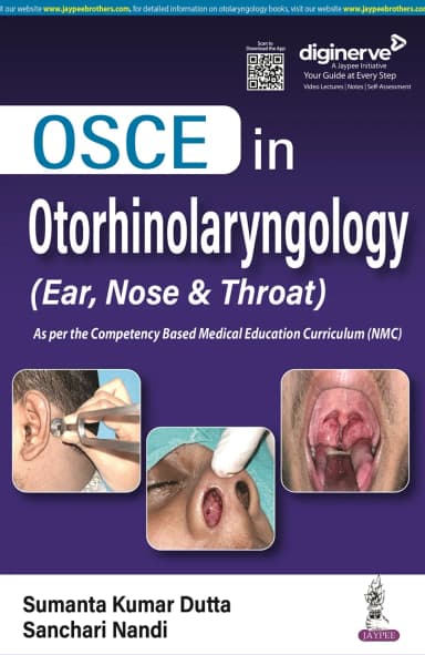Image of - OSCE in Otorhinolaryngology (Ear, Nose & Throat)