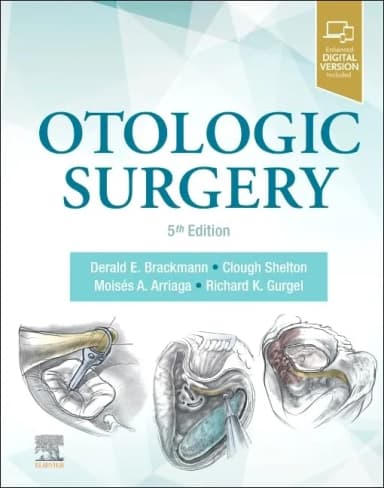 Thumbnail - Otologic Surgery - 5E