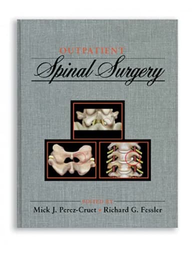 Image of - Outpatient Spinal Surgery - 1st Edition