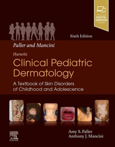 Image of - Paller and Mancini - Hurwitz Clinical Pediatric Dermatology-6E