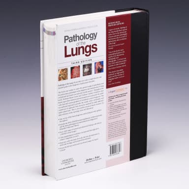 Image of - Pathology of the Lungs Expert Consult - Third Edition