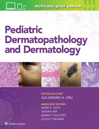 Image of - Pediatric Dermatopathology and Dermatology | 1st Edition