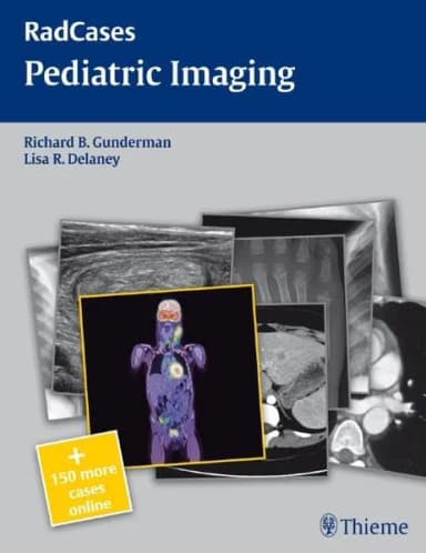 Image of - Pediatric Imaging