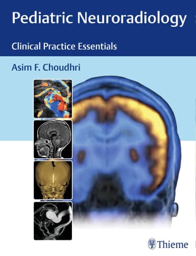Image of - Pediatric Neuroradiology The Essentials 1st Edition