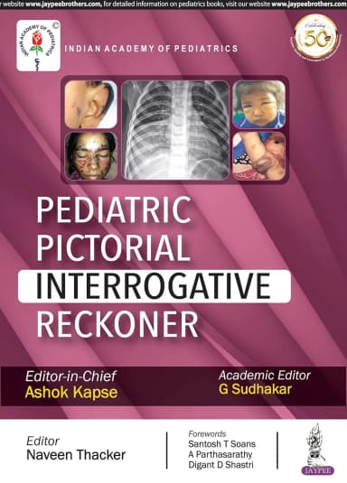 Image of - Pediatric Pictorial Interrogative Reckoner (IAP) - 1st Edition 2019