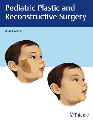 Image of - Pediatric Plastic and Reconstructive Surgery 1st Edition