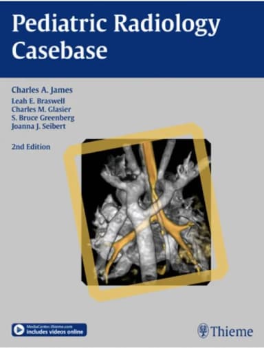 Image of - Pediatric Radiology Casebase - 2nd Edition