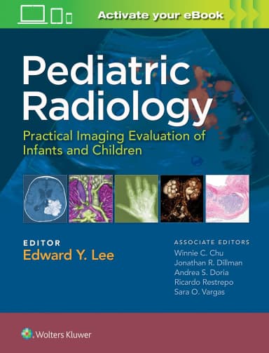 Image of - Pediatric Radiology: Practical Imaging Evaluation of Infants and Children