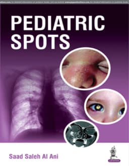 pediatric-spots