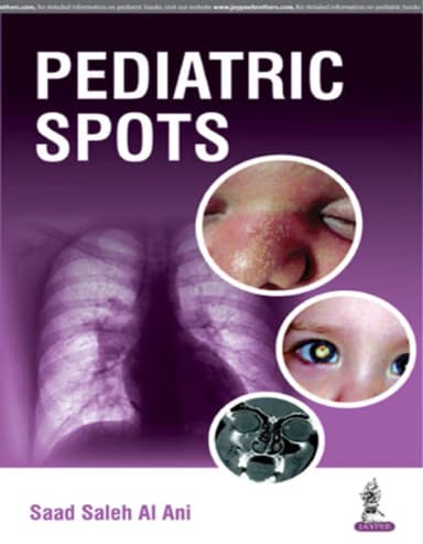 Image of - Pediatric Spots