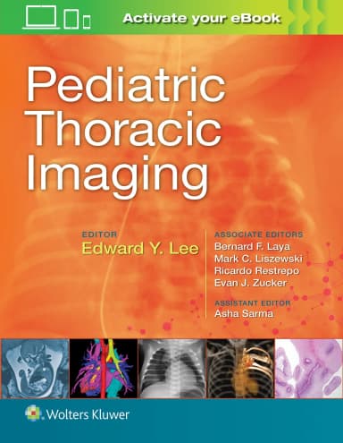 Image of - Pediatric Thoracic Imaging | 1st Edition