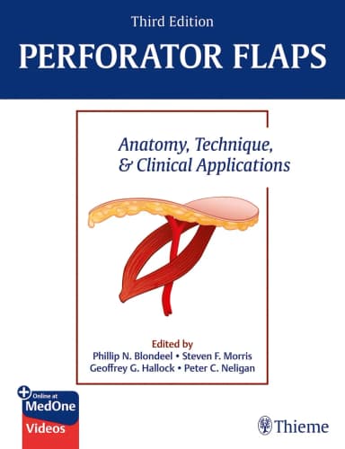 Image of - Perforator Flaps: Anatomy, Technique, & Clinical Applications, 3rd Edition
