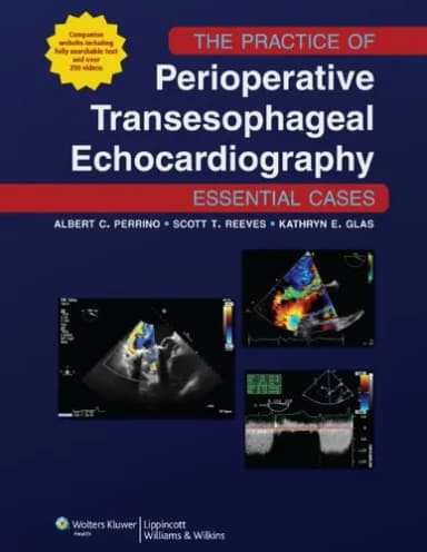 Image of - Practice of Perioperative Transesophageal Echocardiography Essential | 1st Edition