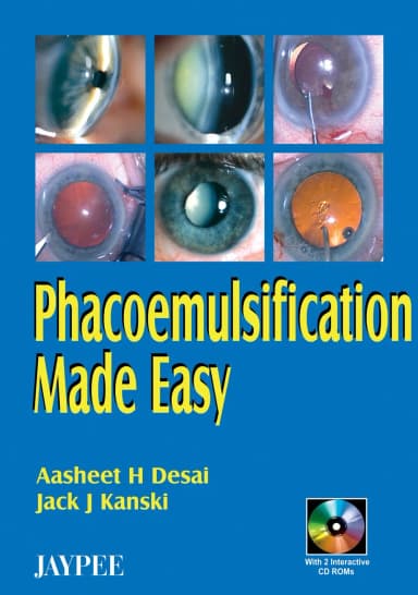 Image of - Phacoemulsification Made Easy with 2 CD Rom - 1st Edition