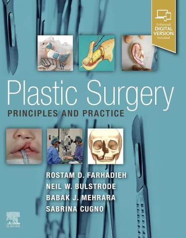 Image of - Plastic Surgery - Principles and Practice-1E