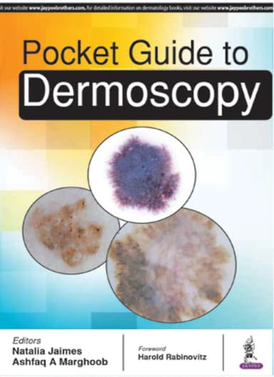 Image of - Pocket Guide to Dermoscopy