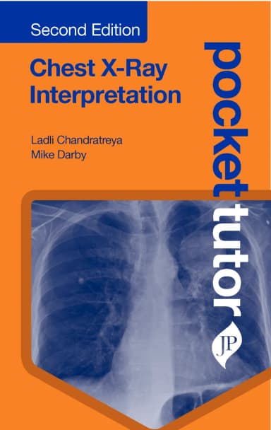 Image of - Pocket Tutor Chest X-Ray Interpretation
