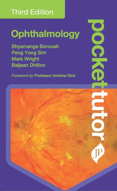 Image of - Pocket Tutor Ophthalmology | Third Edition