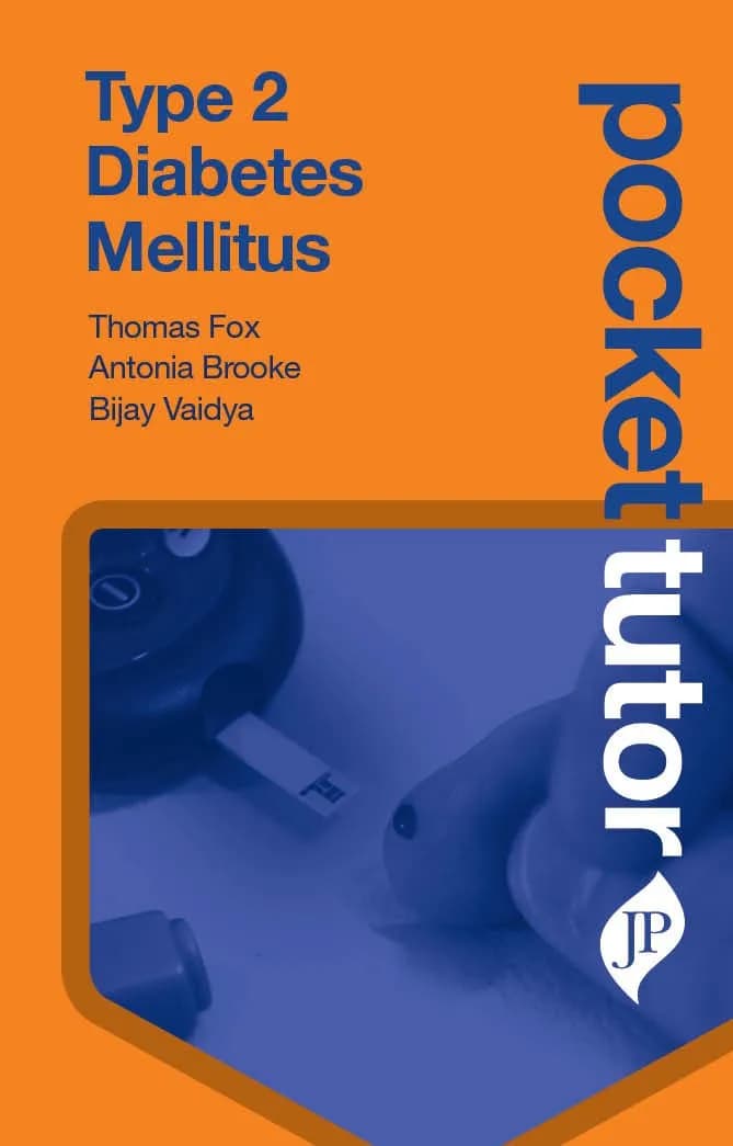 Type 2 Diabetes Mullitus Pocket Tutor - 1st Edition