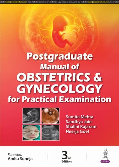 Image of - Postgraduate Manual of Obstetrics and Gynecology for Practical Examination