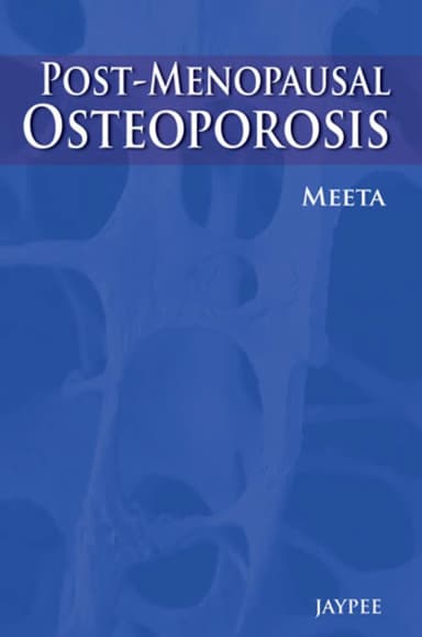 Image of - Postmenopausal Osteoporosis | Basic and Clinical Concepts
