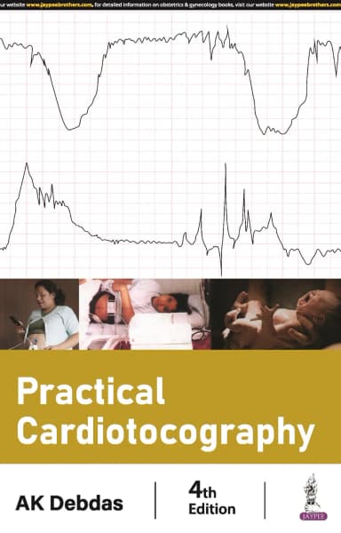 Image of - Practical Cardiotocography