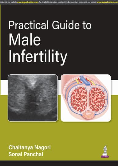 Image of - Practical Guide to Male Infertility
