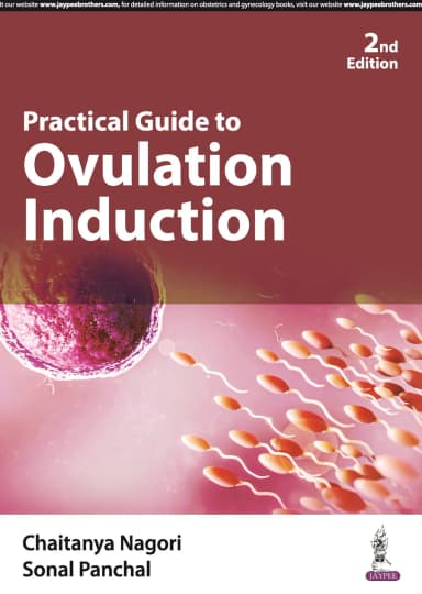 Image of - Practical Guide to Ovulation Induction