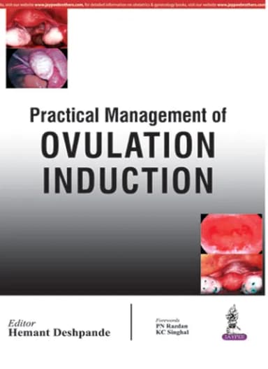 Image of - Practical Management of Ovulation Induction - 1st Edition