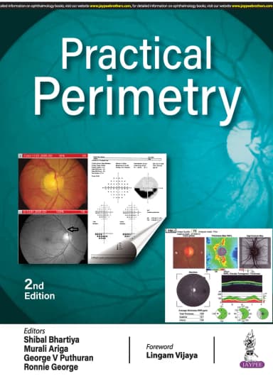 Image of - Practical Perimetry