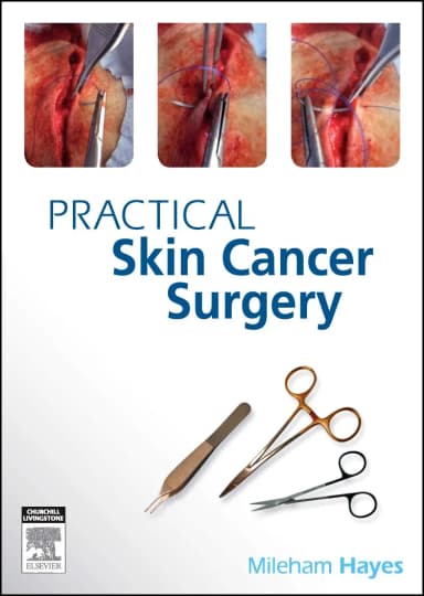 Image of - Practical Skin Cancer Surgery-1E
