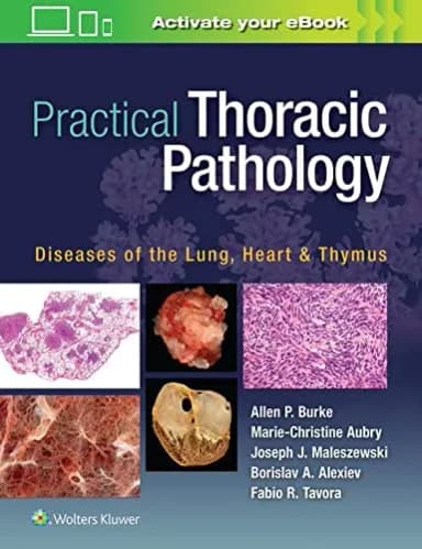 Image of - Practical Thoracic Pathology: Diseases of the Lung, Heart, and Thymus