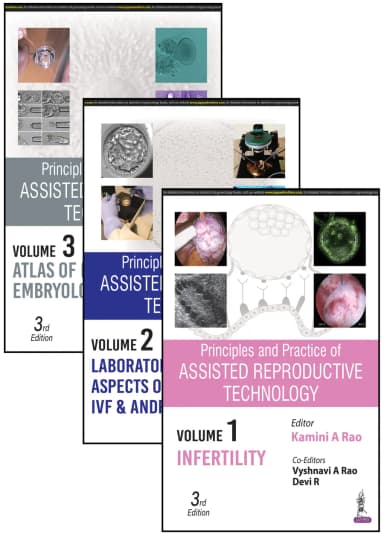 Image of - Principles and Practice of Assisted Reproductive Technology (3 Volumes)
