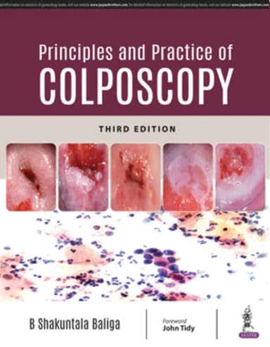 Thumbnail - Principles And Practice Of Colposcopy