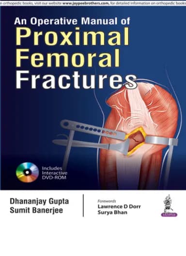 Image of - An Operative Manual of Proximal Femoral Fractures with Dvd-rom - 1st Edition
