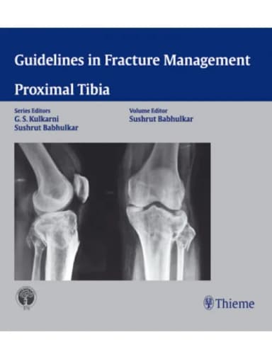 Image of - Proximal Tibia - 1st Edition